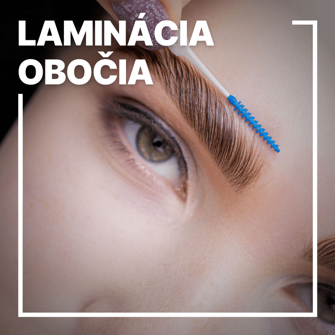 Laminacia obocia - Global Education Centre